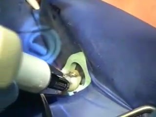 Periodontal Splinting