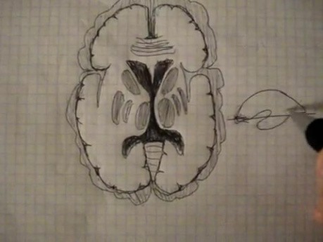 Basal Ganglia - Neuroanatomy Lectures - 30