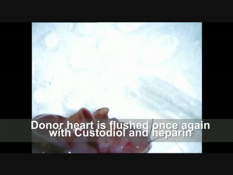 Heterotopic Heart Transplant. BN Rat Model