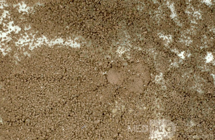 Aspergillus NigerPlate Culture