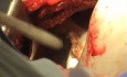 Thoracic surgery 