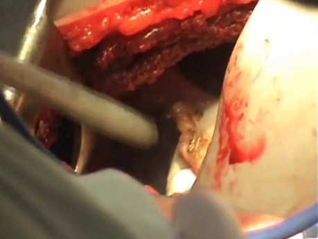 Thoracic surgery 