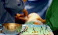 Minimally Invasive Thoracic Surgey Unit