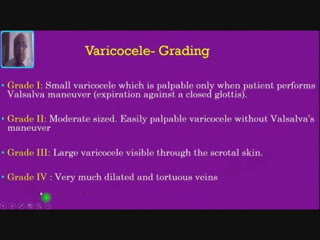 Scrotal Swellings - Varicocele -  Case no 4