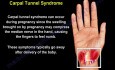 Causes and Treatment of the Wrist Pain - Part 1