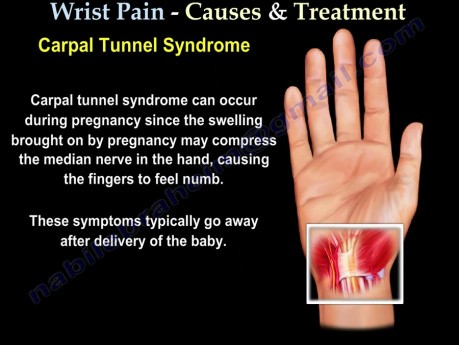 Causes and Treatment of the Wrist Pain - Part 1