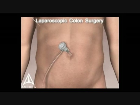 Amerra 3D Medical Visualization - Demo Trailer 2009