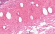 Small Intestine Jejunum - Histology