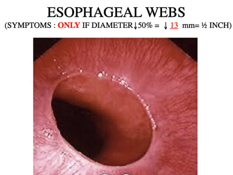 Esophageal Emergencies