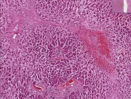 Normal Liver 