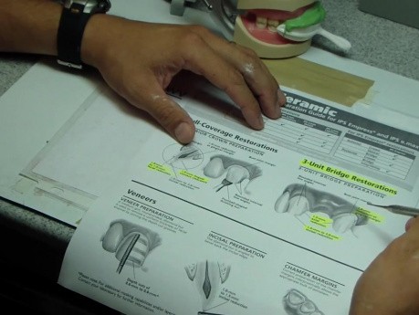 Anterior Bridge Preparation, Part 2 - E.Max Dimensions