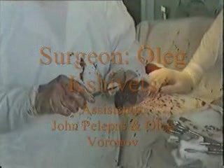 Right Upper Lobectomy