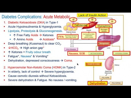 Diabetic Ketoacidosis