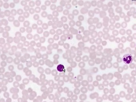 Blood Smear - Histology