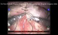 Robotic Surgeon's Knot