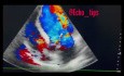2. Echocardiography - What You See?