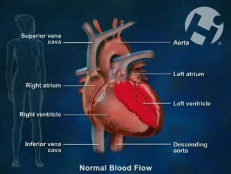 Normal Arterial Blood Supply to the Brain