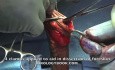 Adult Circumcision