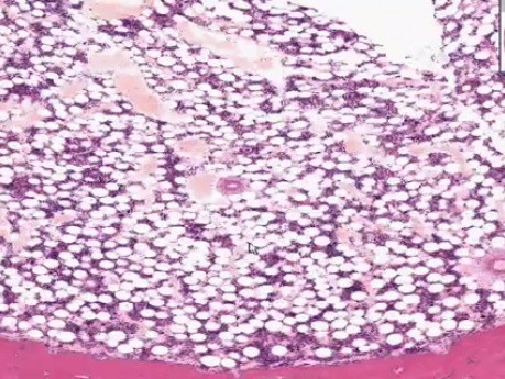 Bone Marrow - Histology