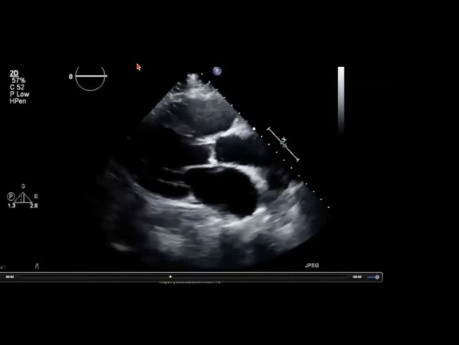A Glance to the Past of Echocardiography - The People Behind the Names