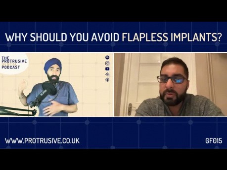 Why Should You Avoid Flapless Implants? GF015