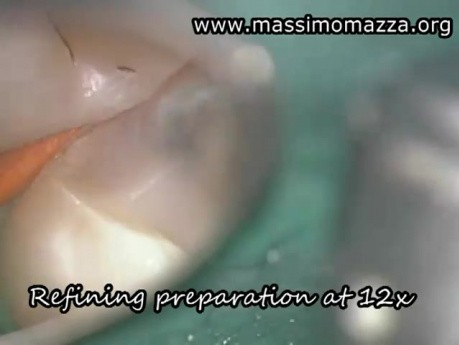 Value Of Microscopy In Conservative Dentistry