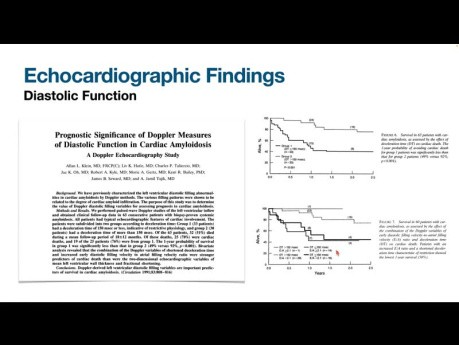 Echocardiographic Assessment of Cardiac Amyloidosis