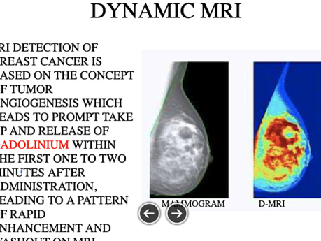 Surgical Radiology of the Breast