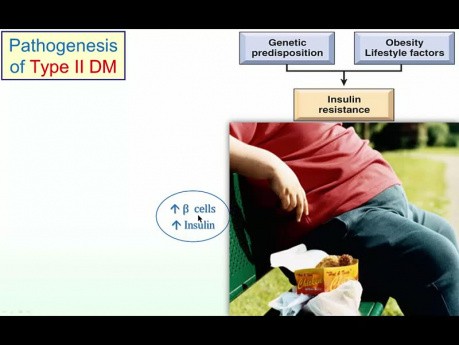 Pathogenesis of Diabetes
