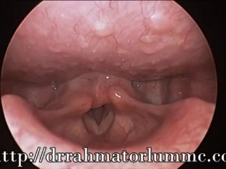 Laryngeal Evaluation