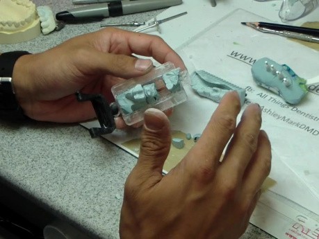 Crown & Bridge Lab: Triple Trays And Lab Mistakes - Die Destruction.Arg.