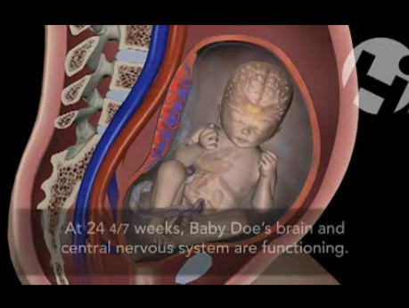 Premature Birth