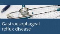 Gastroesophageal Reflux Disease