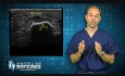 Ultrasound Technology used to treat Plantar Fasciitis, Achilles Tendinitis