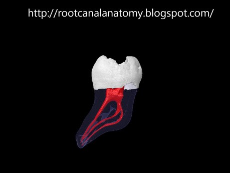 Mandibular Second Molar - Root Canal Anatomy