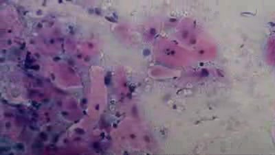 Cervical canal - Cytological examination