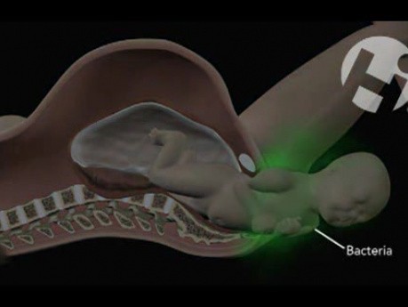 Infection Through Birth