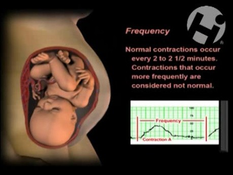 Fetal Heart Strip Tutorial