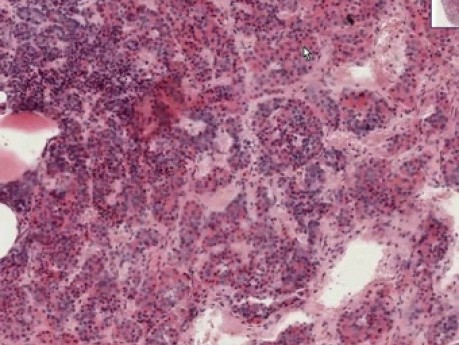 Pituitary - Histology