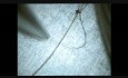 Microsurgery Tutorials. Bonus: Thinner than a strand of hair!
