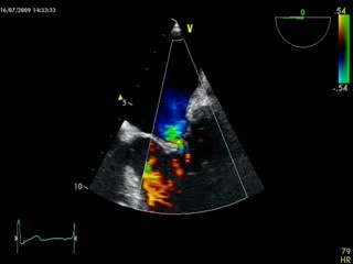 Rheumatic Disease