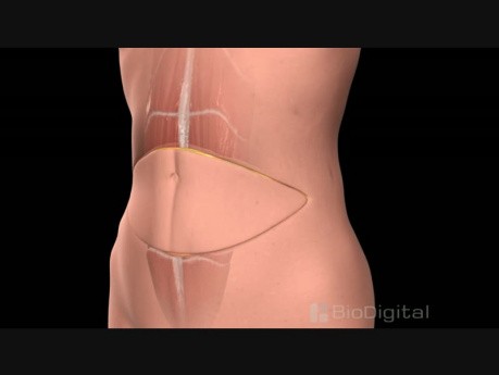 TRAM Breast Reconstruction