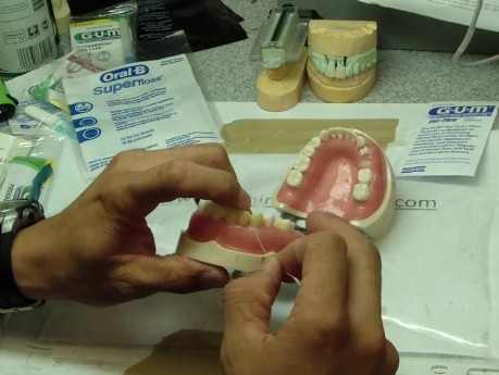 Dental Bridge Hygiene 101