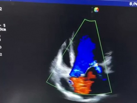 13. Echocardiography Case - What You See?