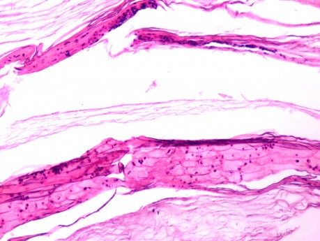 Histology of Tympanic Membrane Cast